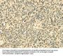 ECE2 Antibody