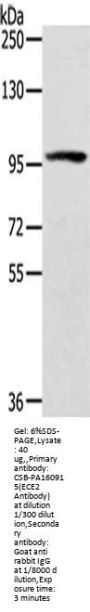 ECE2 Antibody