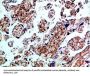 BMPR1B Antibody