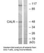CALR Antibody