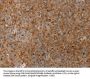 SERPINB2 Antibody