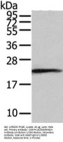 RAB2A Antibody