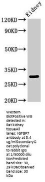 IGFBP7 Antibody