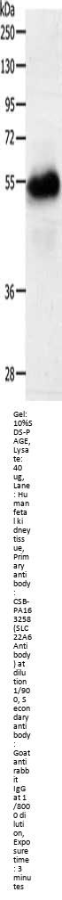 SLC22A6 Antibody