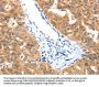 LRPPRC Antibody