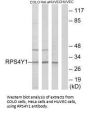 RPS4Y1 Antibody
