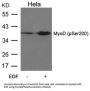 Phospho-MYOD1 (Ser200) Antibody