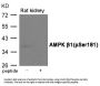 Phospho-PRKAB1 (Ser181) Antibody