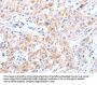 SCARB1 Antibody
