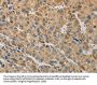 MIP Antibody