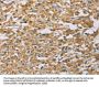 MIP Antibody