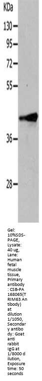 TRIM63 Antibody