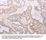 TPO Antibody