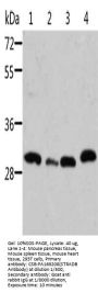 STRADB Antibody