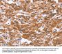 Rabbit anti-human GLMN polyclonal antibody
