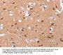 Rabbit anti-human GLMN polyclonal antibody