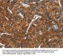 CTBP1 Antibody