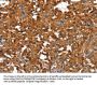 CTBP1 Antibody