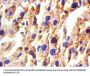 Hp Antibody
