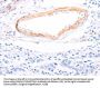 TPM1 Antibody