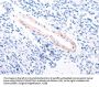 TPM1 Antibody