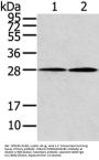 KCNMB1 Antibody