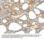 CCR8 Antibody