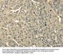 TRIB2 Antibody