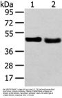 TRIB2 Antibody