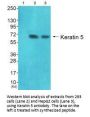 KRT5 Antibody