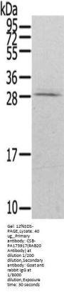 RAB20 Antibody