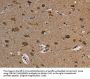 Rabbit anti-human REG3A polyclonal antibody