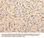 Rabbit anti-human CMKLR1 polyclonal antibody