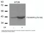 Phospho-MAPK14 (Thr180) Antibody