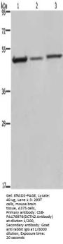 Rabbit anti-human DCTN2 polyclonal antibody