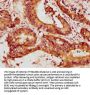Mmp13 Antibody