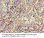 TGFB3 Antibody