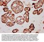 TGFB3 Antibody