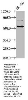 KAT5 Antibody