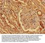 KAT5 Antibody