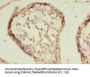 HDAC1 Antibody