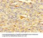 HDAC1 Antibody