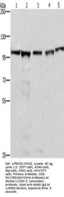 MCM6 Antibody