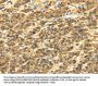 SLC6A19 Antibody