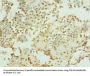 TEP1 Antibody