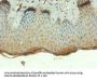 TEP1 Antibody