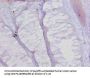 COL17A1 Antibody