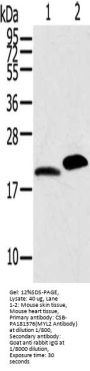 MYL2 Antibody