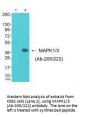 MAPK1/MAPK3 (Ab-205/222) Antibody