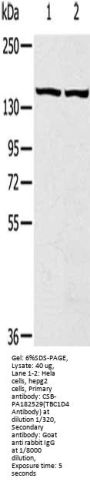 TBC1D4 Antibody